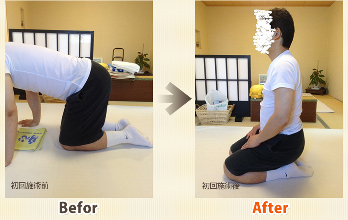 患者さんビフォーアフター　その7