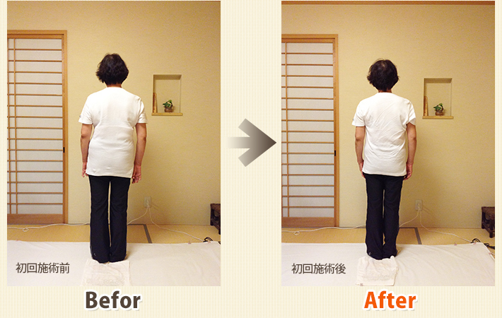 患者さんビフォーアフター　その3