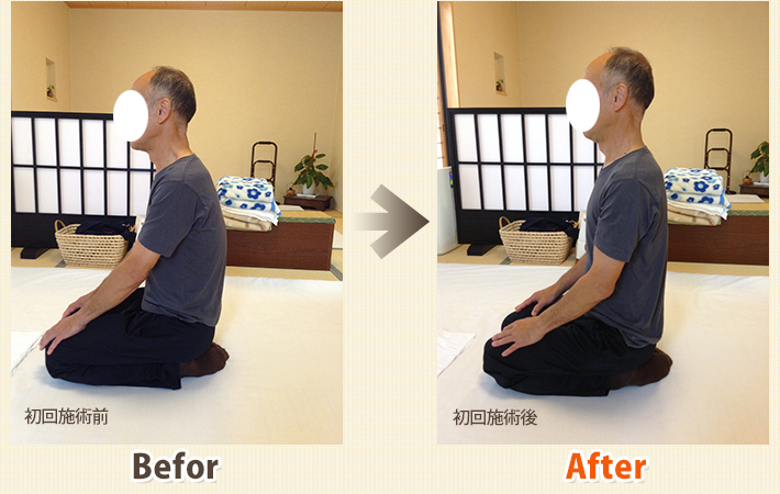 患者さんビフォーアフター　その4