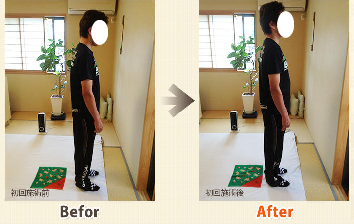 患者さんビフォーアフター　その13