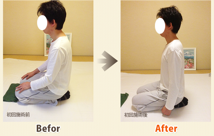患者さんビフォーアフター　その14
