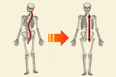 変形した身体と健康に機能する時の身体